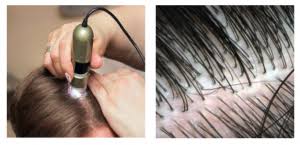 Modalità del tecnico&nbsp;tricologo