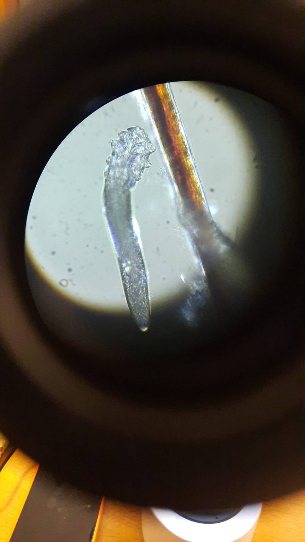 Demodex: Piccoli Abitanti della Nostra&nbsp;Pelle